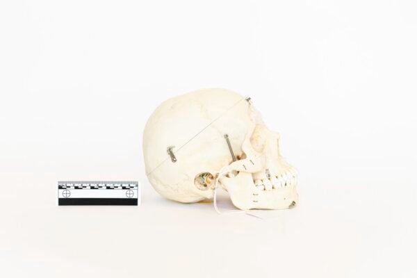 Demonstrative Skull (0057) - Image 2