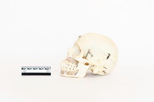 Demonstrative Skull (0057) - Image 3