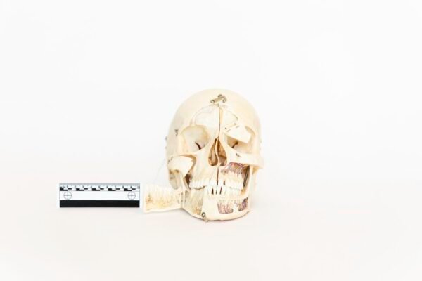 Demonstrative Skull (0057)