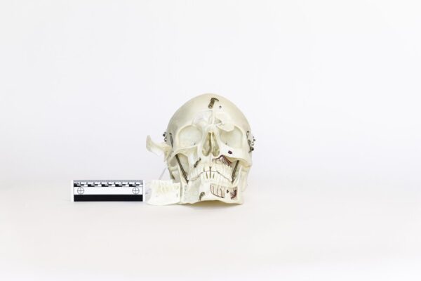Demonstrative Skull (0079)