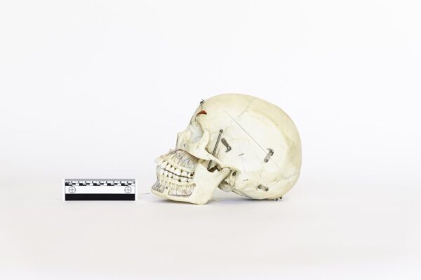Explanatory Skull (0081) - Image 3