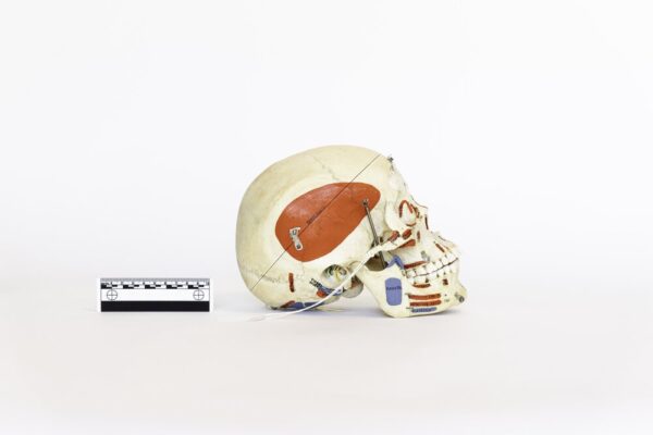 Explanatory Skull (0081) - Image 2