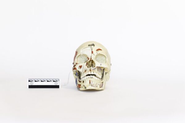Explanatory Skull (0081)