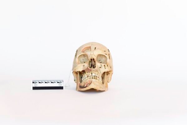 Antique Demonstrative Skull (0080)