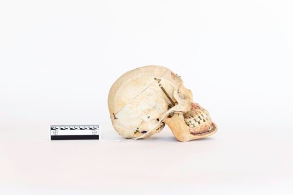 Antique Demonstrative Skull (0080) - Image 3