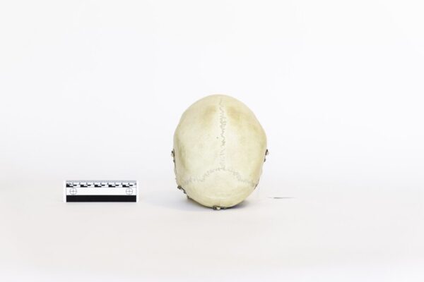 Explanatory Skull (0081) - Image 4