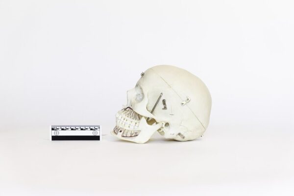 Demonstrative Skull (0079) - Image 3