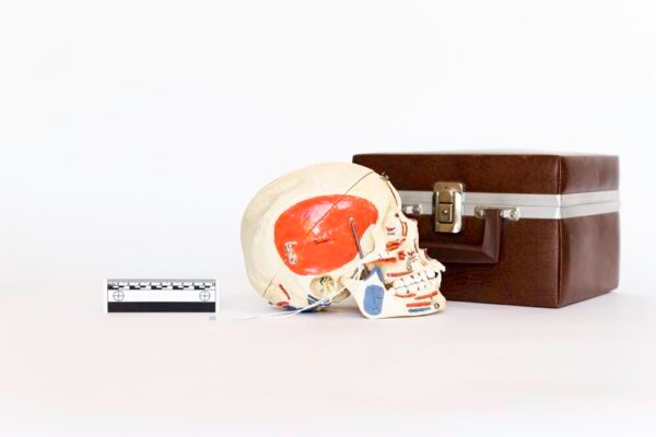 Explanatory Dental Skull (0086) - Image 2