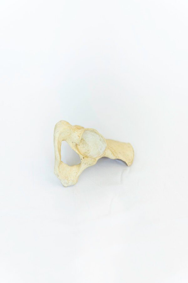 Pelvises With Light Patina - Image 2