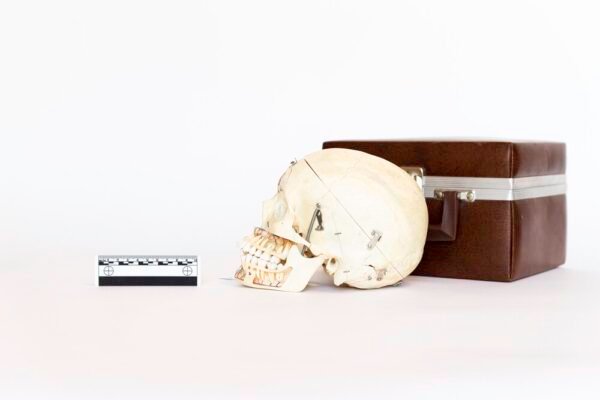 Explanatory Dental Skull (0086) - Image 3