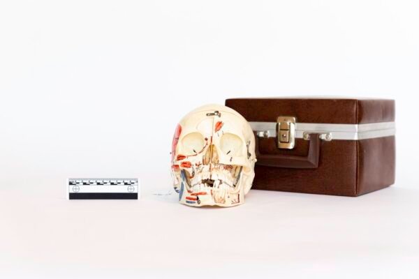 Explanatory Dental Skull (0086)