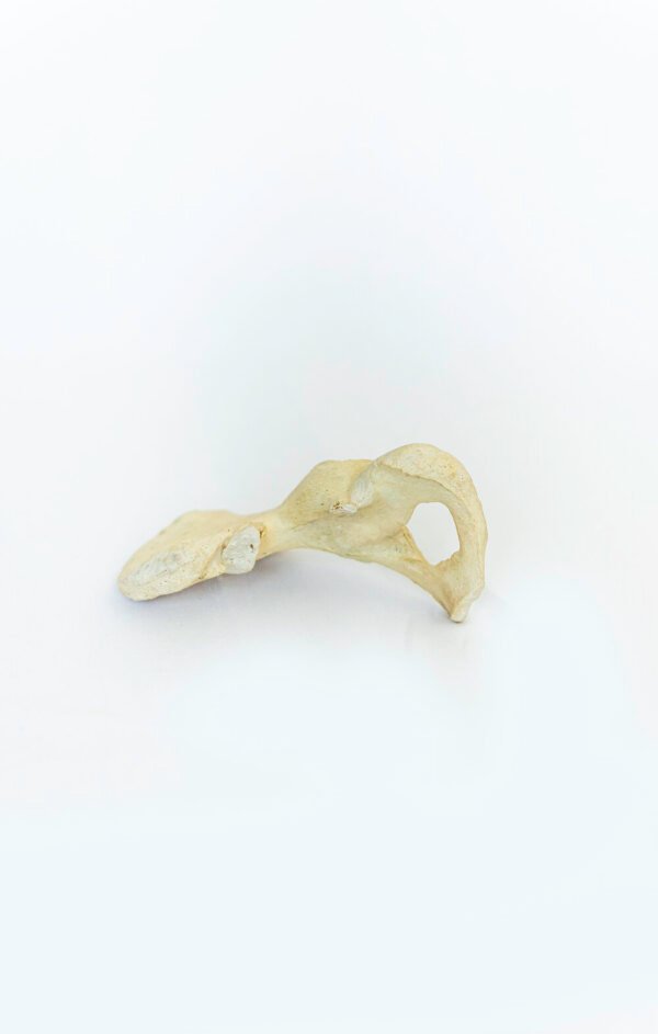 Pelvises With Light Patina - Image 3