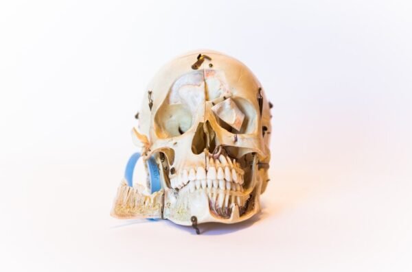 Demonstrative Skull (0091)