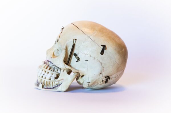 Demonstrative Skull (0091) - Image 3
