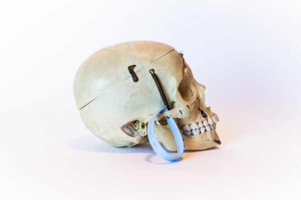 Demonstrative Skull (0090) - Image 3