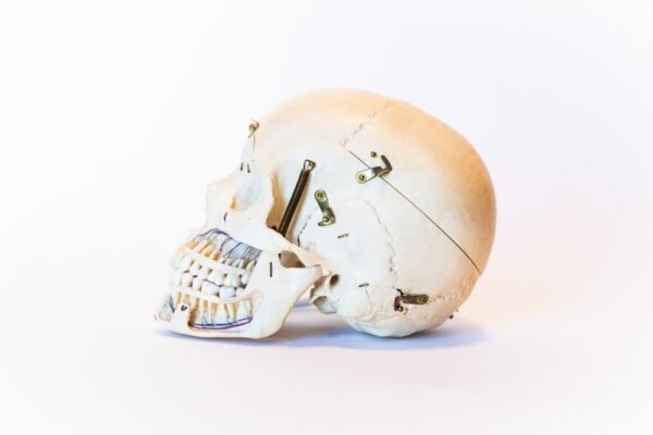 Demonstrative Skull (0090) - Image 2