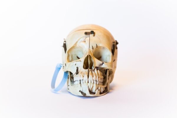 Demonstrative Skull (0090)