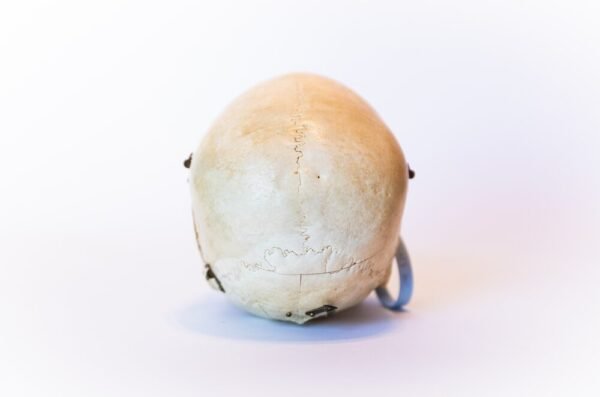 Demonstrative Skull (0091) - Image 4