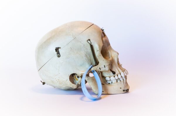 Demonstrative Skull (0091) - Image 2