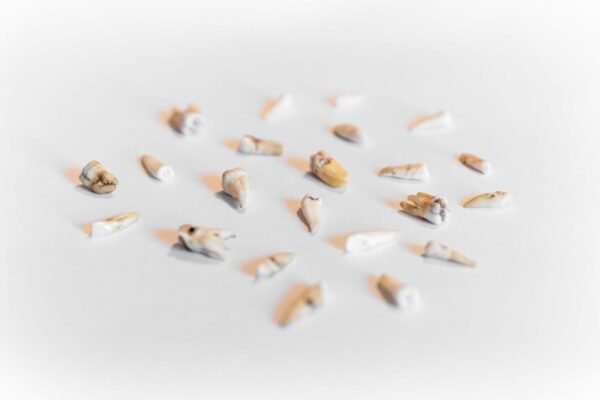 Teeth - Image 2