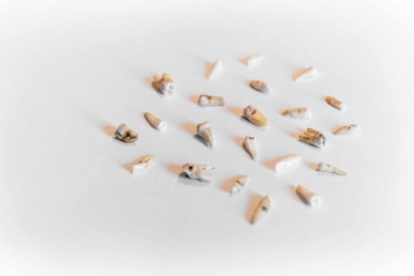 Teeth - Image 4
