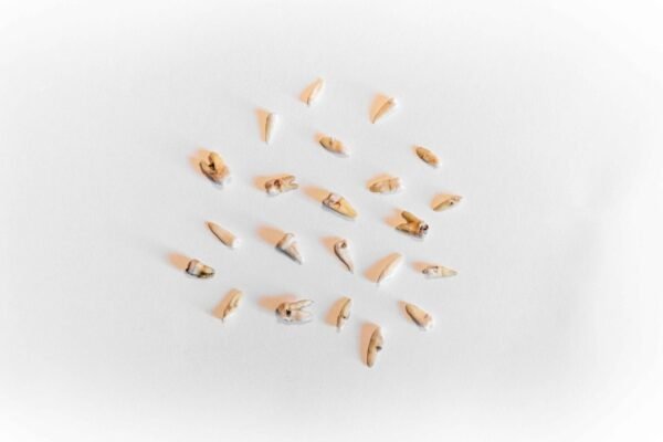 Teeth - Image 3