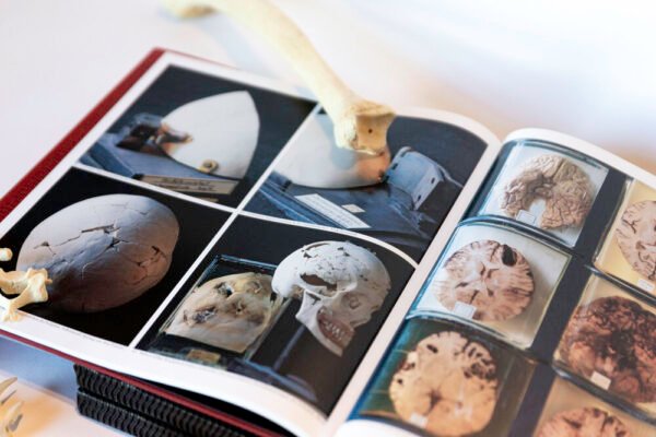 The Historical Collection of the Institute for Forensic Medicine in Vienna