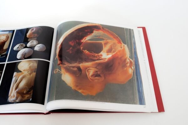 The Historical Collection of the Institute for Forensic Medicine in Vienna - Image 4