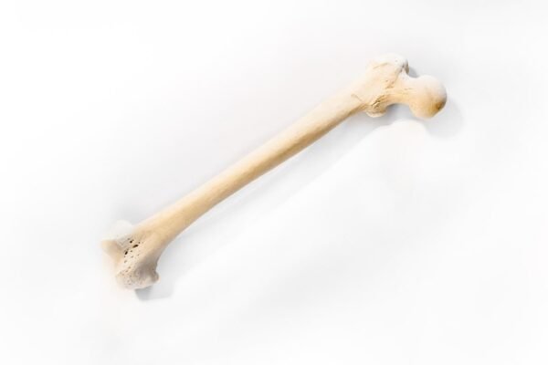 Femurs With Light Patina