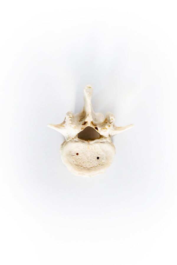 human Vertebrae