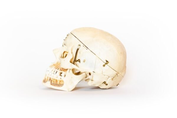 Vintage Demonstrative Skull (0116) - Image 2