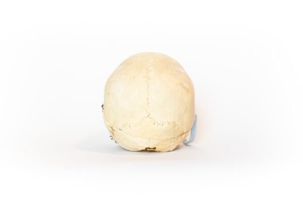 Vintage Demonstrative Skull (0116) - Image 4