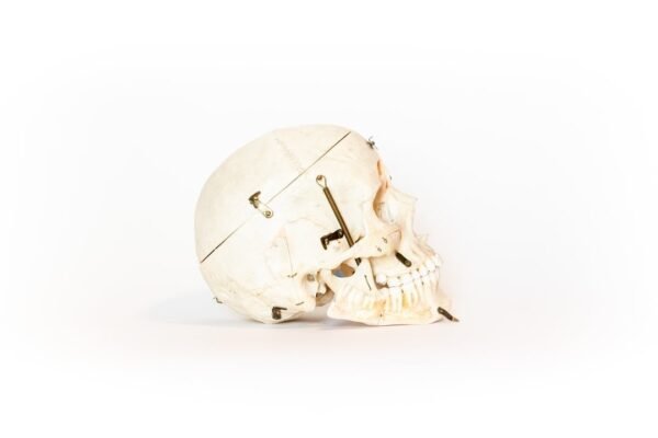 Vintage Demonstrative Skull (0117) - Image 3