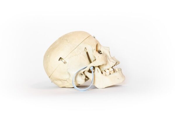 Medical Skull With Bruxism (0123) - Image 2