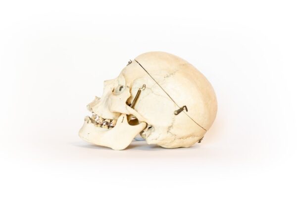 Medical Skull With Bruxism (0123) - Image 3