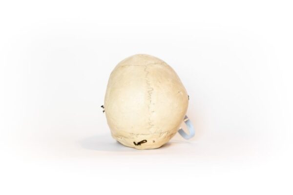 Medical Skull With Bruxism (0123) - Image 4