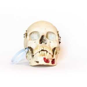 Medical Skull With Exposed Teeth Roots (0130)