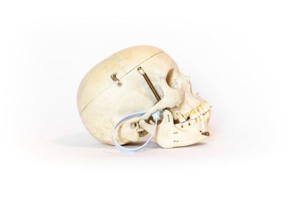 Medical Skull With Exposed Teeth Roots (0130) - Image 2