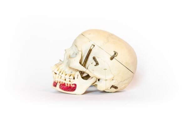 Medical Skull With Exposed Teeth Roots (0130) - Image 3
