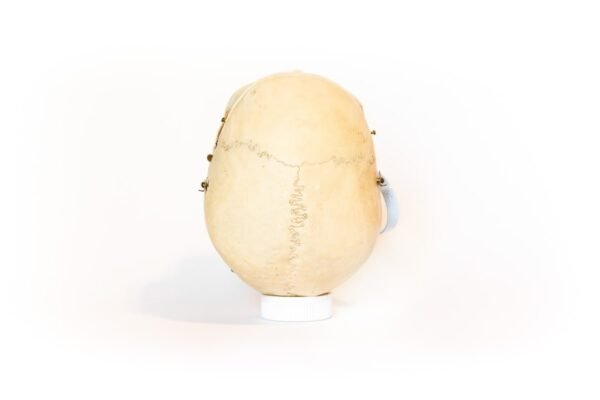 Medical Skull With Exposed Teeth Roots (0130) - Image 4
