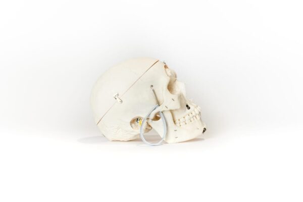 Demonstrative Skull (0156) - Image 3