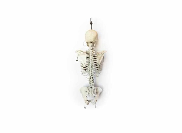 Human Torso and Skull (0913) - Image 4