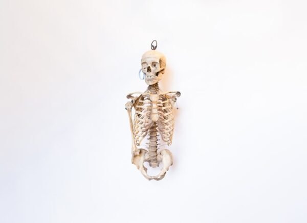 Oddfellows Medical Skeleton-Torso and Skull (0914)