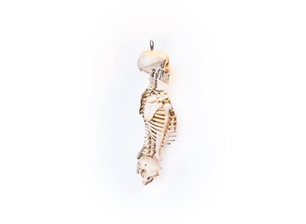 Oddfellows Medical Skeleton-Torso and Skull (0914) - Image 3