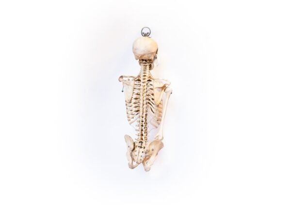 Oddfellows Medical Skeleton-Torso and Skull (0914) - Image 4