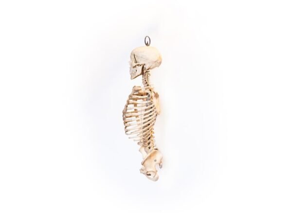 Oddfellows Medical Skeleton-Torso and Skull (0914) - Image 2