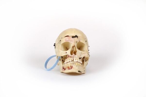 Kilgore International Demonstrative Skull In Case (0176) - Image 3