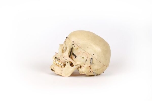 Kilgore International Demonstrative Skull In Case (0176) - Image 4