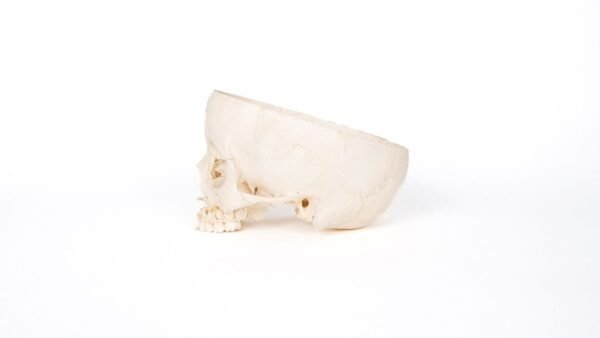 Pediatric Skull (0188) - Image 2