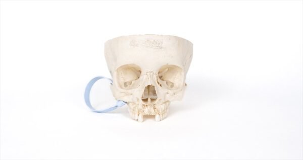 Pediatric Skull (0188)